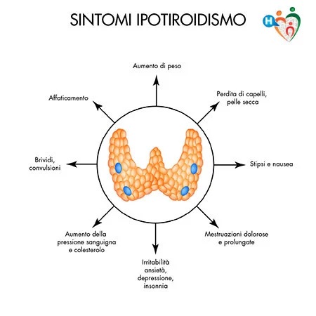 ipotiroidismo.jpg